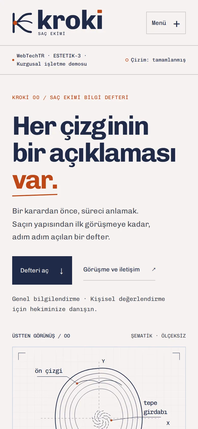Kroki Saç Ekimi tasarımının telefon görünümü (Estetik klinik)